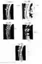 Fig. 20 - Assessment of Spinal Anatomy