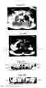 Fig. 23 - Assessment of Spinal Anatomy