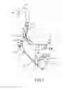 Fig. 02 - Selectively adjustable arm and shoulder support