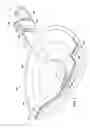 Fig. 02 - Drape having microstrain inducing projections for treating a wound site