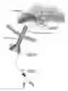 Fig. 01 - Method of Performing Laparoscopic Surgery Using a Multi-Access Channel Surgical Trocar