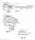 Fig. 02 - Method of Performing Laparoscopic Surgery Using a Multi-Access Channel Surgical Trocar