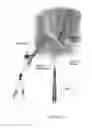 Fig. 07 - Method of Performing Laparoscopic Surgery Using a Multi-Access Channel Surgical Trocar