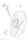 Fig. 02 - Medical article anchoring system