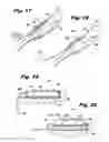 Fig. 08 - Assembly For Use With Surgery System