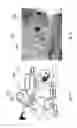 Fig. 02 - LASER SYSTEMS AND METHODS FOR VAPORIZATION OF PROSTATE AND OTHER TISSUE