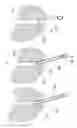Fig. 08 - LASER SYSTEMS AND METHODS FOR VAPORIZATION OF PROSTATE AND OTHER TISSUE