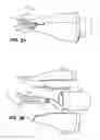 Fig. 06 - Electrosurgical devices for tonsillectomy and adenoidectomy