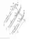 Fig. 07 - Orthopaedic implant and fastener assembly