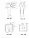 Fig. 41 - Surgical tools for arthroplasty