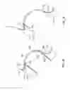Fig. 44 - Surgical tools for arthroplasty