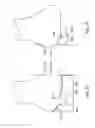 Fig. 45 - Surgical tools for arthroplasty