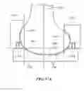 Fig. 49 - Surgical tools for arthroplasty