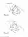 Fig. 08 - Surgical instrument and system of surgical instruments