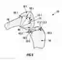 Fig. 04 - POSITIONING GUIDE AND A FEMUR BONE CUTTING GUIDE SYSTEM