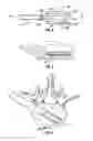 Fig. 03 - Devices and methods for treating bone