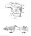Fig. 10 - Devices and methods for treating bone
