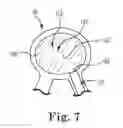 Fig. 09 - Systems and methods for forming a cavity in, and delivering curable material into, bone