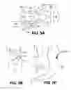 Fig. 07 - Apparatus for treating a portion of a reproductive system and related methods of use