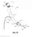 Fig. 30 - Apparatus for treating a portion of a reproductive system and related methods of use