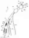 Fig. 01 - Apparatus for treating a portion of a reproductive system and related methods of use