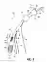 Fig. 02 - Apparatus for treating a portion of a reproductive system and related methods of use