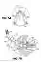 Fig. 09 - Apparatus for treating a portion of a reproductive system and related methods of use