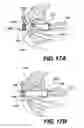 Fig. 19 - Apparatus for treating a portion of a reproductive system and related methods of use