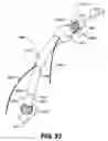 Fig. 26 - Apparatus for treating a portion of a reproductive system and related methods of use