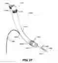 Fig. 30 - Apparatus for treating a portion of a reproductive system and related methods of use