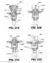 Fig. 34 - Apparatus for treating a portion of a reproductive system and related methods of use