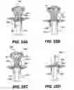 Fig. 35 - Apparatus for treating a portion of a reproductive system and related methods of use
