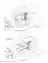Fig. 02 - Method and apparatus for circulatory valve repair