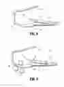 Fig. 09 - Dissection tip and introducer for surgical instrument