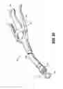 Fig. 28 - Dissection tip and introducer for surgical instrument