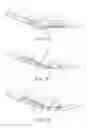 Fig. 08 - Suture system and assembly
