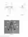 Fig. 02 - ENDOSCOPIC FASCIAL CLOSURE DEVICES AND METHODS FOR USING SAME