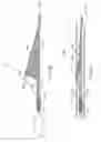 Fig. 49 - SYSTEMS, METHODS AND DEVICES FOR REMOVING OBSTRUCTIONS FROM A BLOOD VESSEL