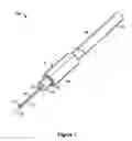 Fig. 02 - Apparatus and method for elongating a tendon