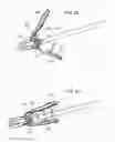 Fig. 46 - Method for fastening a hinged surgical fastener on tissue
