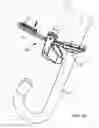 Fig. 65 - Method for fastening a hinged surgical fastener on tissue