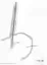 Fig. 77 - Method for fastening a hinged surgical fastener on tissue