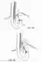 Fig. 79 - Method for fastening a hinged surgical fastener on tissue