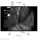 Fig. 84 - Method for fastening a hinged surgical fastener on tissue