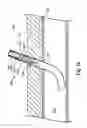 Fig. 10 - CLOSURE DEVICE