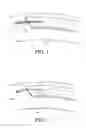 Fig. 02 - System and method for attaching soft tissue to bone