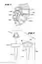 Fig. 02 - Facet arthroplasty devices and methods