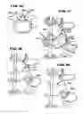 Fig. 08 - Facet arthroplasty devices and methods