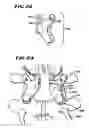 Fig. 10 - Facet arthroplasty devices and methods