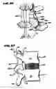 Fig. 12 - Facet arthroplasty devices and methods